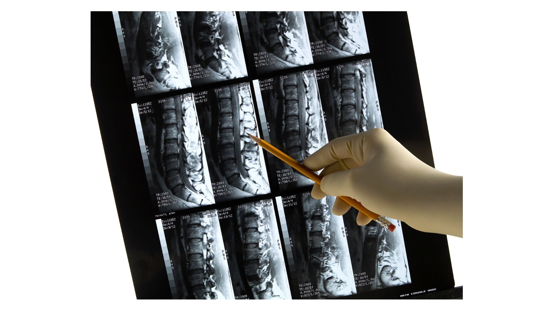 Which Chiropractor in Omaha Uses INSiGHT Scanning Technology?